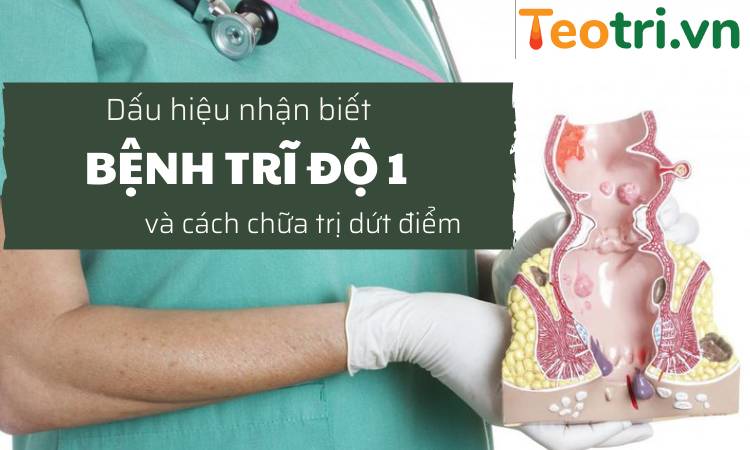 Dấu hiệu nhận biết trĩ độ 1 và cách điều trị dứt điểm