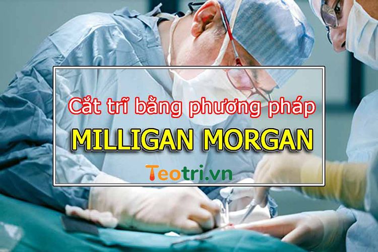 Cắt trĩ bằng phương pháp Milligan Morgan là gì? 1