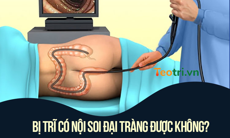 Bị trĩ có nội soi đại tràng được không?