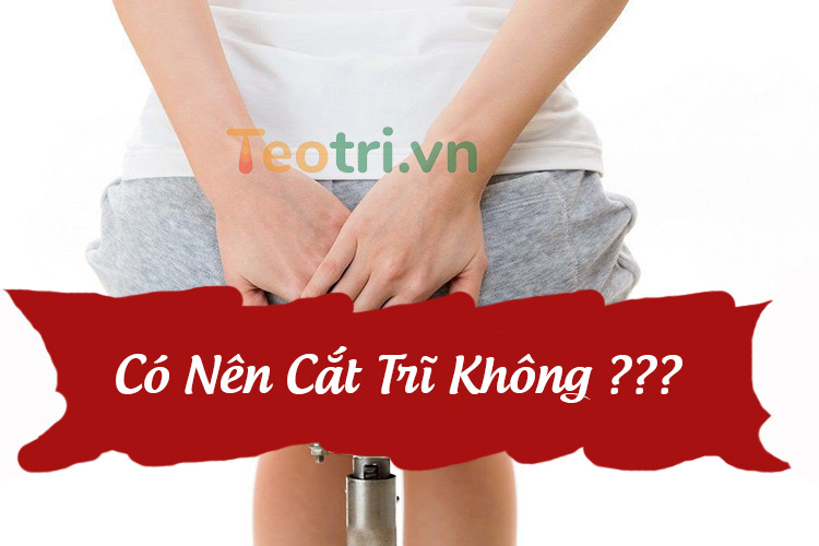 Có nên cắt trĩ không? Khi nào cần phẫu thuật?