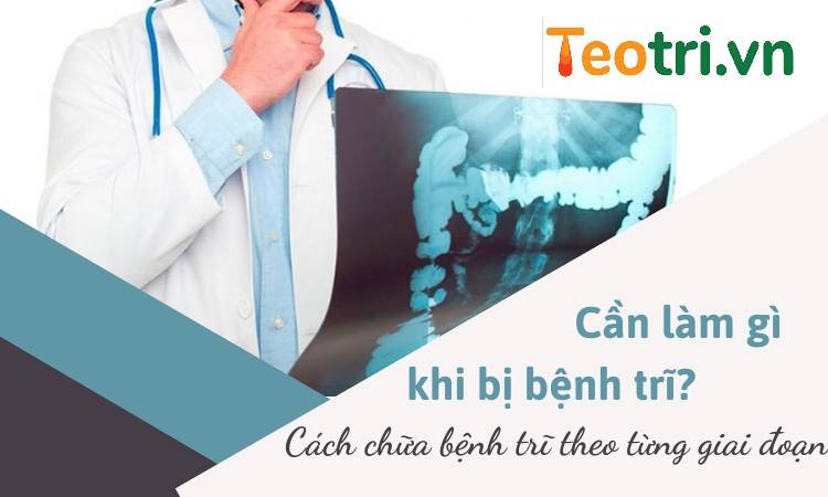 Bị trĩ phải làm sao? Cách chữa bệnh trĩ theo từng giai đoạn