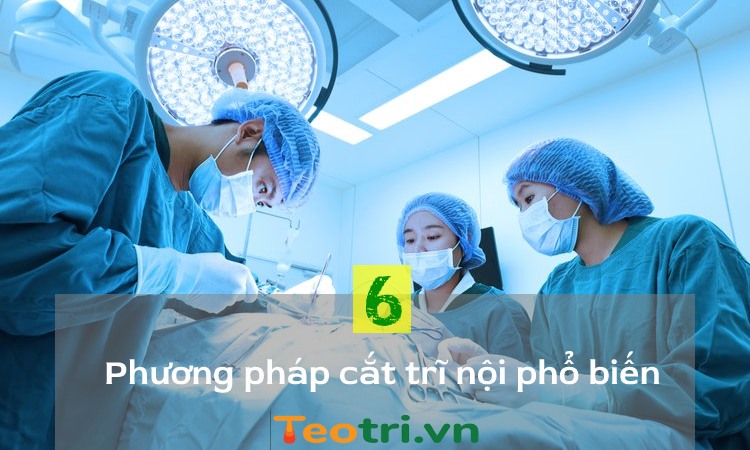 6 phương pháp phẫu thuật cắt mổ trĩ nội phổ biến nhất hiện nay