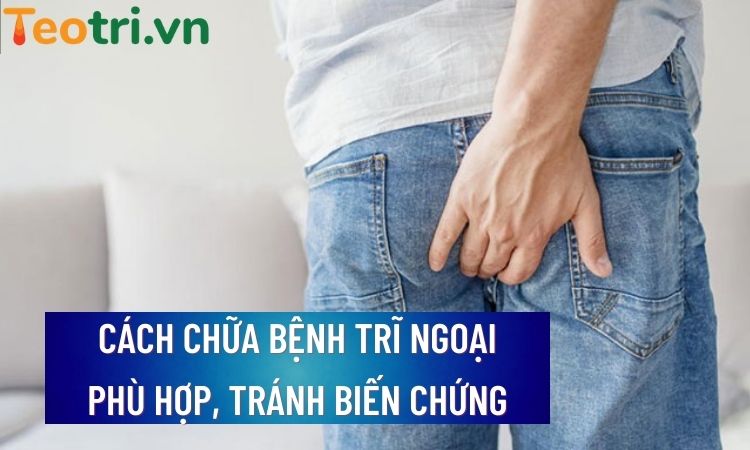 Chữa bệnh trĩ ngoại như thế nào hiệu quả?