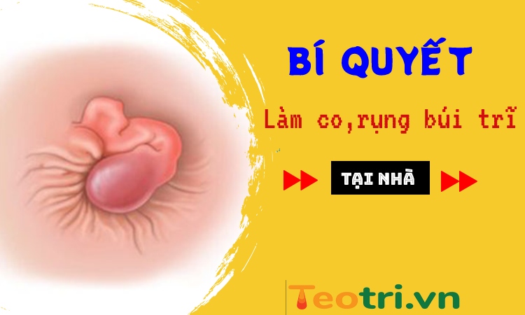 Bí quyết làm co, rụng búi trĩ ngoại đơn giản tại nhà