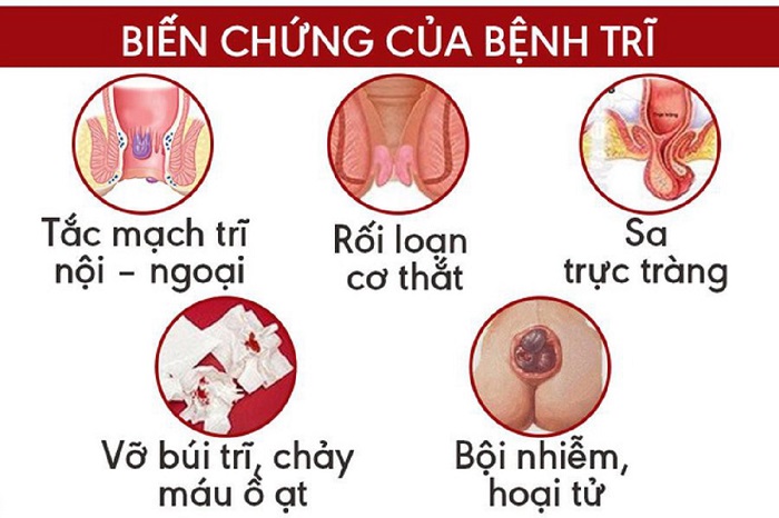 bien-chung-cua-benh-tri_5421.jpg